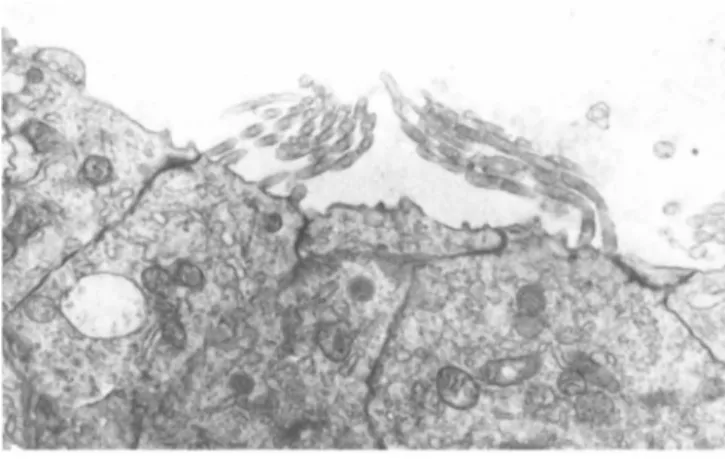 FIGURE 11 In this electron micrograph the sterocilia of the  sensory cell on the right are abnormally bent