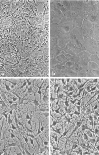 FIGURE 1 Live phase-contrast photographs demonstrating mor- mor-phological transformation in fetal brain cells