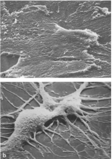 FIGURE 2 Scanning electron microscopy of brain epithelial  cells Ca) before and Cb) after morphological transformation by  brain extract CX 2500)