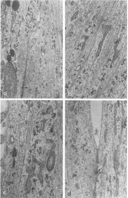 FIGURE 4 Transmissxon electron microscopy of brain epithelial  cells after transformation, showing: (a) numerous tonof ilaments in  two apposing cell processes; arrow indicates a junction complex  between the two processes (X 25,000); (b) detail of tonofil