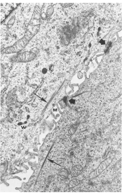 FIGURE 4 Electron micrograph of 647V cells In passage §19. 