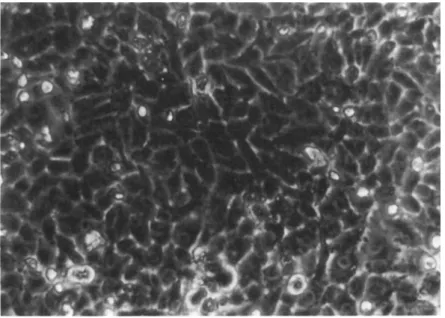 FIGURE 2 Phase contrast photograph of monolayer culture of  292VT cells in passage #30