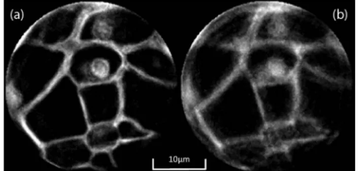 Fig. 7. Reconstructed image of Convallaria majalis in (a) absence and in (b) presence of asynchronous motion error.