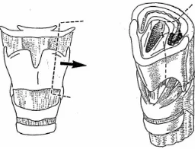 Figure 19.: Fiberoscopic image of post horizontal supraglottic larynxresection with open and closed