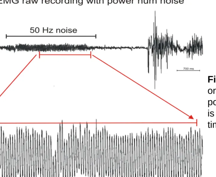 Figure 16. Electrical artifact originating from the 50 Hz power lines. The noisy signal is represented in two different time scales