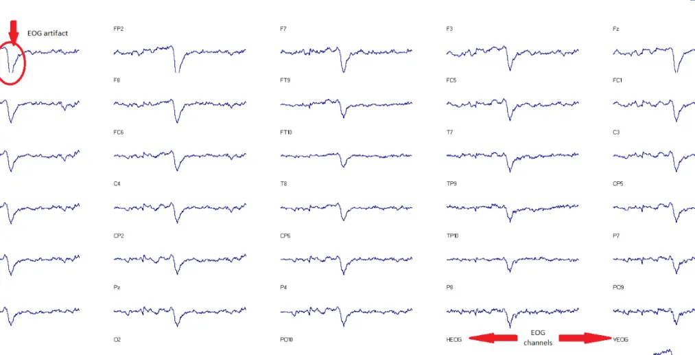 Figure 5. EOG (electro-oculogram) artifact present on all of the channels of a 2 second segment of an EEG recording