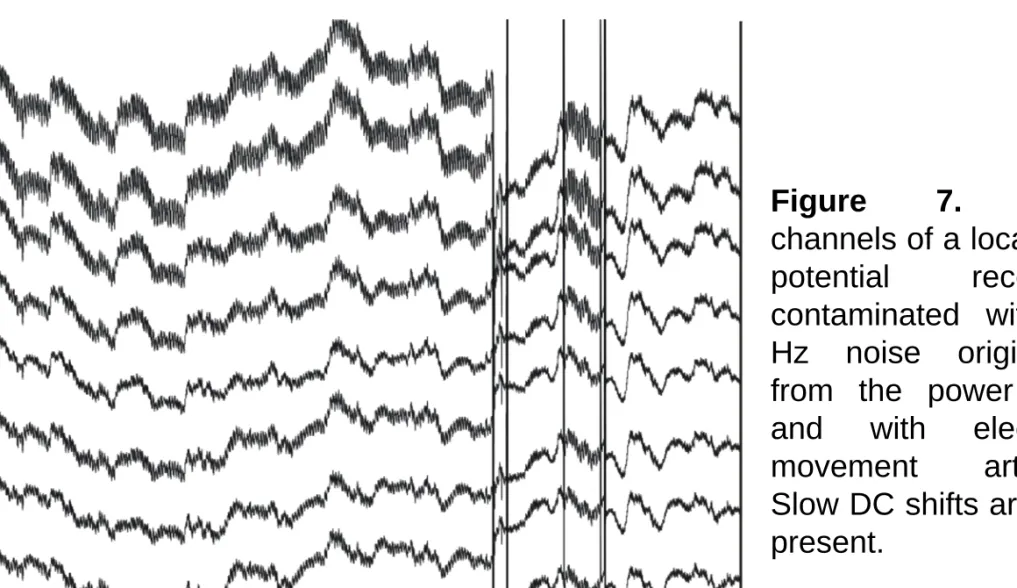 Figure 7. Eight channels of a local field potential recording contaminated with 50 Hz noise originating from the power lines and with electrode movement artifacts.