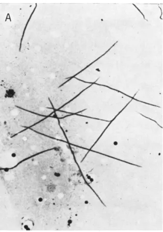 FIG. 3A. Upper: Myosin filaments prepared by dialysis of monomeric myosin  (in 0.5 M KCl) against pH 6.2, 0.30 M KCl