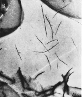 FIG. 3B. Upper: Myosin filaments prepared by dialysis of monomeric myosin  (in 0.5 M KCl) against pH 7.1, 0.25 M KCl