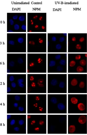 Figure 6. UV-B radiation induces the intracellular trafficking of nucleoplasmic NPM in  HPV-Ker cells