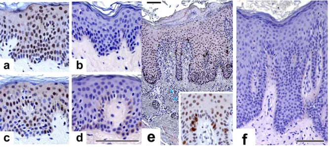 Figure 4. Immunohistochemical analysis of nucleophosmin (NPM) protein expressions in  healthy and psoriatic skin samples