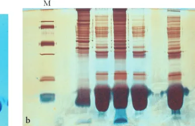 4-7. ábra. Lizált mosott vörösvértestek fehérjéi (M: marker) a) CBB R250 festéssel SDS-lapgélen