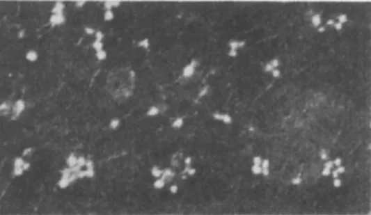 FIG. 2. Bacteriophages of Welchia perfringens (after Elford et al., 1953). 