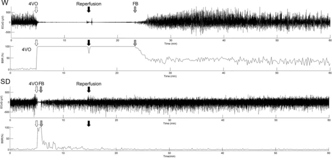 Fig. 1. 60-min ECoG and BSR of Wistar (W) and Sprague–Dawley (SD) rats during and after 4VO, recorded from the primary somatosensory cortex