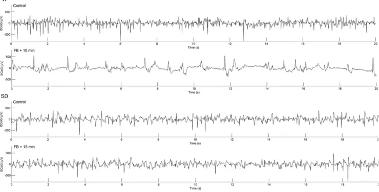 Fig. 3. 20-s samples of typical ECoG waveforms of Wistar (W) and Sprague–Dawley (SD) rats in the baseline period and 15 min after the FB.