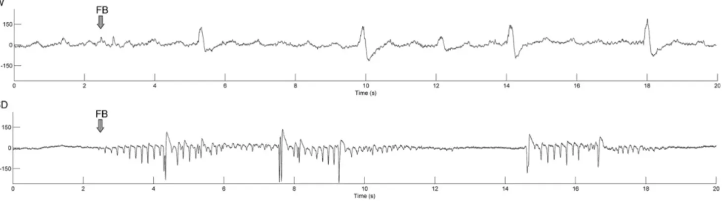 Fig. 5. Typical power spectral density of selected bursts of the ﬁrst 5-min ECoG after the FB in Wistar (W) and Sprague–Dawley (SD) rats