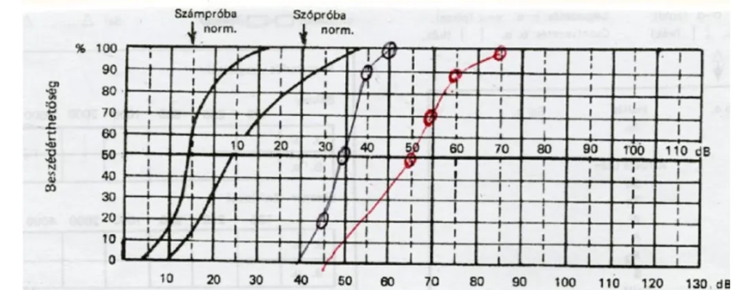 14. kép: két kék vonal-kétoldali számpróba, piros-jobb oldali szópróba, zöld-bal oldali szópróba.