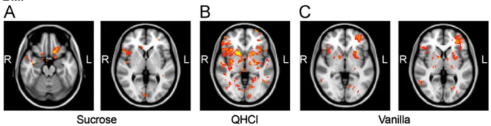 Fig. 3 – Brain regions showing positive correlation with hedonic ratings for sucrose (A), negative correlation with hedonic ratings for the quinine-HCl (B), and brain regions positively correlating with hedonic scores for the vanilla condition (C) (for mor