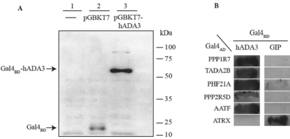 Figure 1 Expression of hADA3 protein in yeast and reporter α -galactosidase activity resulting from the interaction of ADA3–Gal4 BD and Gal4 AD fusion proteins (A) Expression of hADA3 as a Gal4 BD -hybrid protein in yeast