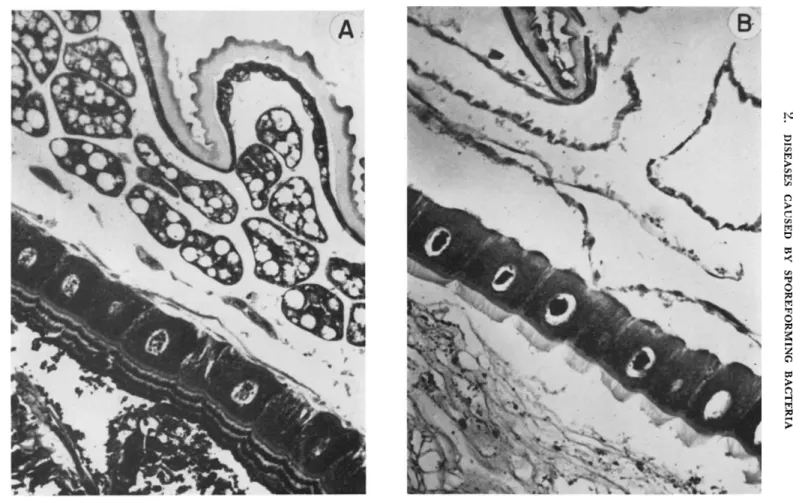 FIG. 1. Sagittal sections of healthy and infected larch sawfly larvae. (A) Midgut epithelial cells of healthy larva