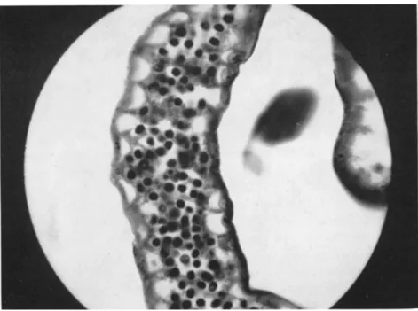 FIG. 4. Cysts of Malpighamoeba (Vahlkampfia) mellificae Prell in the  l u m e n of  Malpighian tubes of Apis mellifera Linnaeus