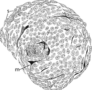FIG. 1. Pseudotumor from abdomen of Drosophila larva showing presence of  spindle cells (s) and beginning of melanization (ra)
