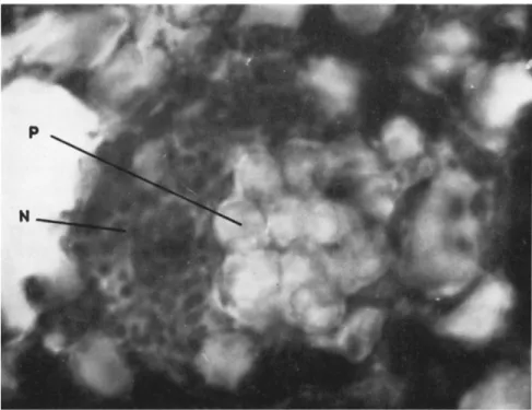 FIG. 6. Polyhedra (P) in the nucleus and Nosema bombycis spores (N) in the  cytoplasm of a fat-body cell in Samia cynthia pupa