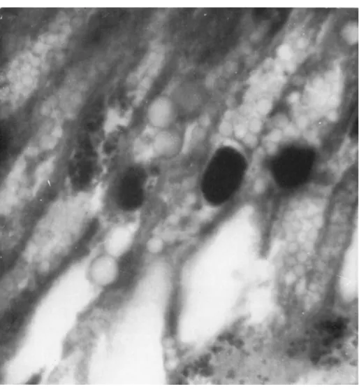 FIG. 1. Photomicrograph of a section through midgut cells of a larva of Estigmene  acrea affected with a cytoplasmic polyhedrosis; note the large rounded polyhedra and  the wide range of size  ( χ 1500)
