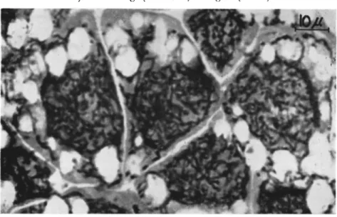 FIG. 5. Section (5 μ) through hypertrophied fat cells of a fifth-instar larva of  Choristoneura murinana (Hübner) infected with granulosis virus