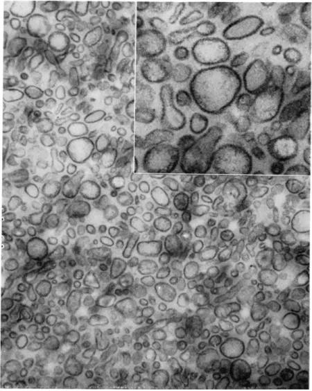 FIG. 8. Sectioned pellet of membrane fraction with osmium tetroxide fixa- fixa-tion. Magnification: X32,000; insert X80,000