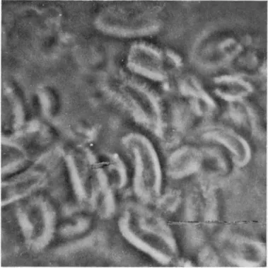 FIG. 3. Isolated brush borders of hamster intestinal epithelial cells, under  phase-contrast illumination