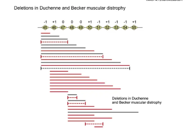 Figure 5.7. Figure 5.7. Duchenne and Becker type muscular dystrophy