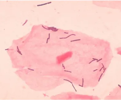 3.2.6. ábra: Listeria monocytogenes [178] 