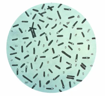 3.2.10. ábra: Clostridium botulinum 