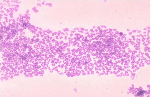 3.2.12. ábra: Microccus mucilaginosus [178] 