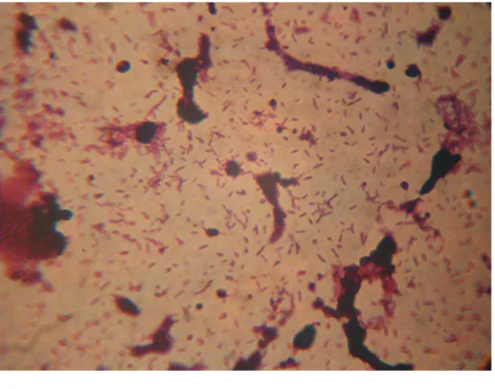 5. ábra A Clostridium sordellii baktérium fénymikroszkópos felvétele. Forrás: saját felvétel