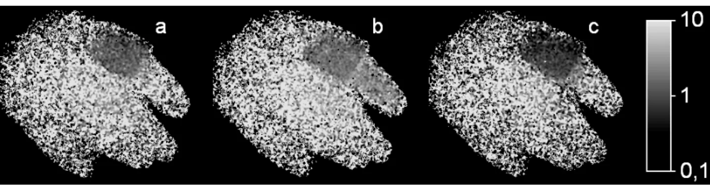 Figure 5. The skin perfusion of the hand and the finger before applying (a), after applying (b) and dissolving (c) ischemia on  the first finger