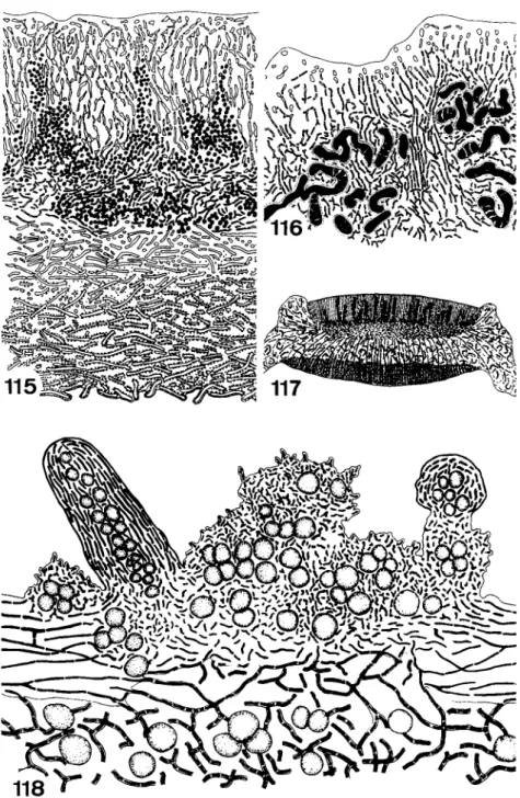 FIGS. 115-118. Fig. 115, section through the thallus of Solorina crocea. The cells of the  Coccomyxa phycobiont reach into the cortex at several places