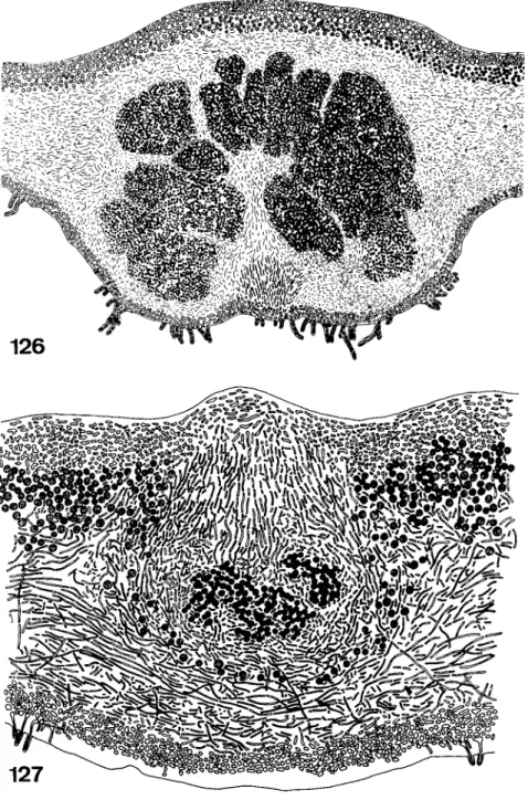 FIGS. 126-127. Fig. 126, section through an internal cephalodium of Lobaria laetevirens  containing large groups of Nostoc