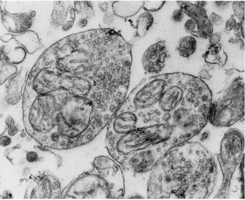 FIG. 2. Synaptosomes (containing vesicles and mitochondria) prepared from a rat  brain homogenate