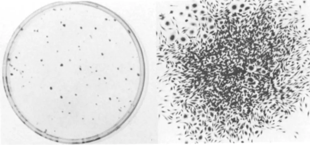 Fig. 1. Colony formation by murine peripheral blood mono- mono-nuclear cells. 10 4  Peripheral blood mononuclear cells were  cultured 14 days in 3-ml liquid growth medium
