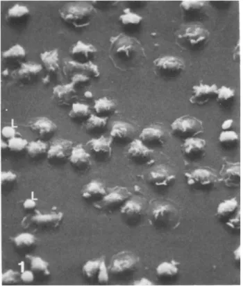 Fig. 1. Scanning electron micrograph of freshly isolated  monocyte undergoing cytoplasmic spreading