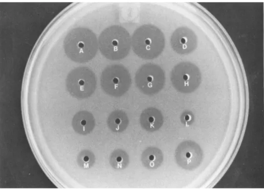 Fig. 2. Lysoplate determination of lysozyme: concentrated  (50x) human lung lavage supernatant (A-D) , rabbit alveolar 