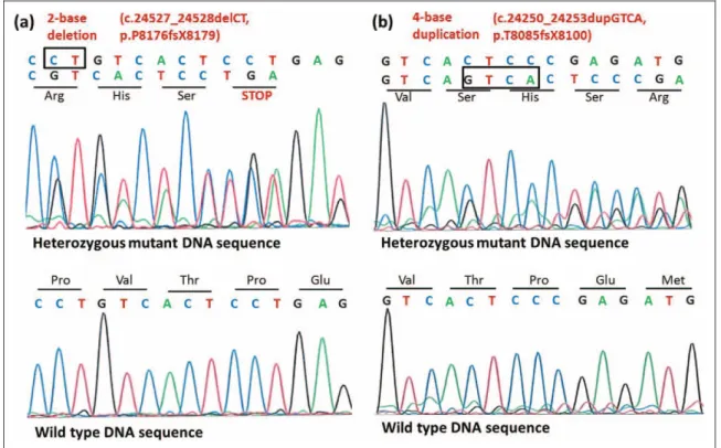 Figure 3. Genetic screening of the affected family. The patient (II/4) and his clinically unaffected father (I/1) carry the deletion in  heterozy-gous form, whereas the other unaffected family members (I/2, II/1, II/2, II/3) carry the wild-type allele