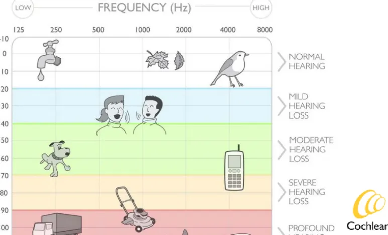 Figure 11. The audiogram. The classification of the hearing loss is shown on the right side of the figure