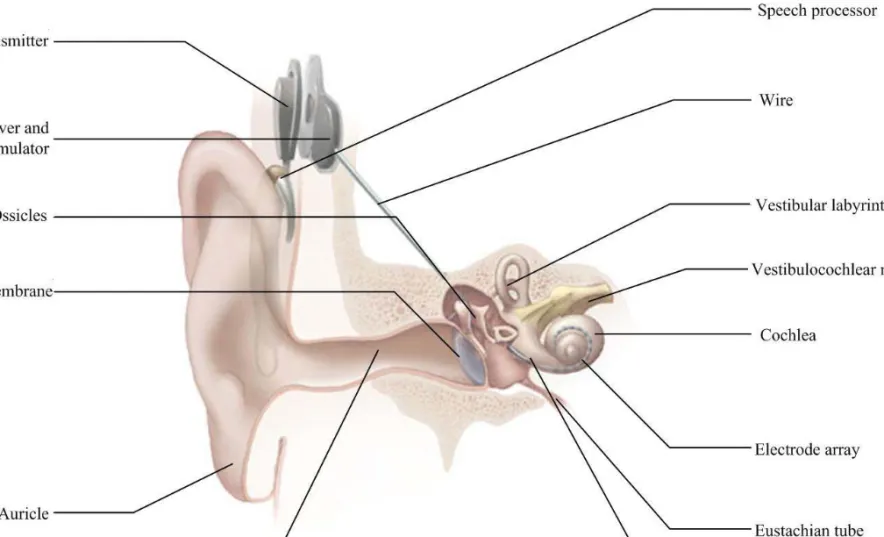 Figure 3. The sturcture of the human ear and the main parts of the cochlear implant 