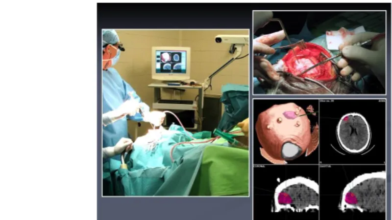 1. ábra: Neuronavigáció. A sebész által tartott eszköz hegye a monitoron a műtét előtt készült képekre vetítve látható.