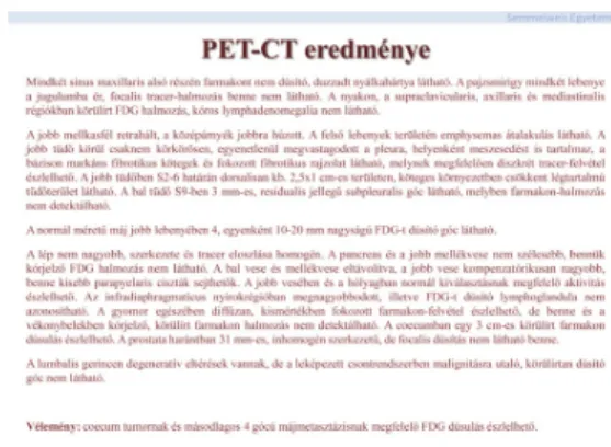 6. ábra: PET CT eredménye
