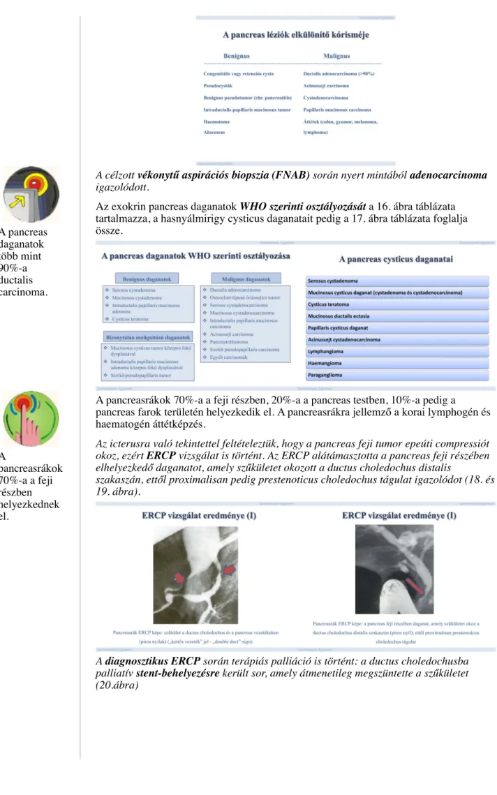 Az exokrin pancreas daganatok WHO szerinti osztályozását a 16. ábra táblázata tartalmazza, a hasnyálmirigy cysticus daganatait pedig a 17