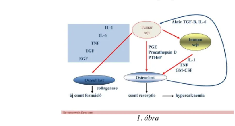 Az 1. ábra a csontmetasztázis patogenézisében szerepet játszó tényezőket tünteti fel.